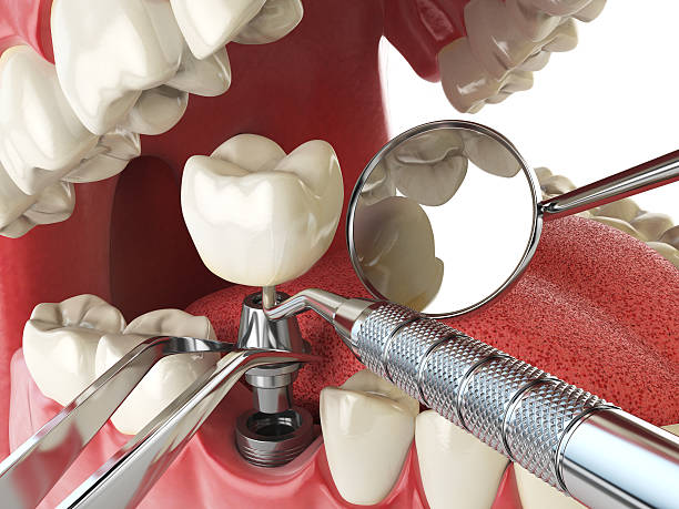 Best Emergency Treatment for Dental Infections or Abscesses in Peebles, OH